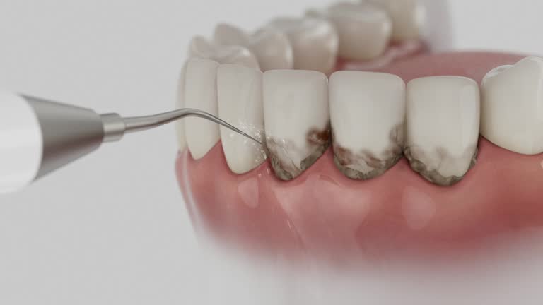 Reliable Dental contractor in Gramercy, LA by Smile Center Dentistry